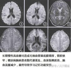 病起木犀已謝